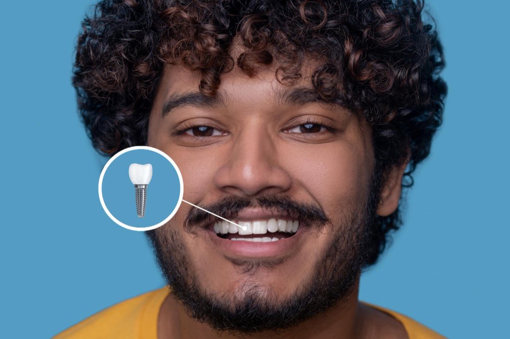Implant Restoration in Indialantic