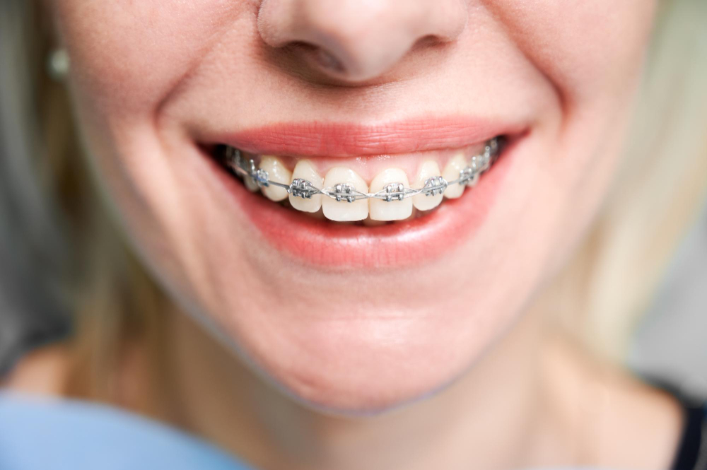 orthodontic services  Indialantic, FL