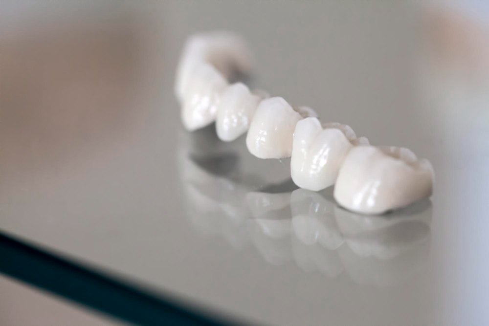 Porcelain Crowns in Indialantic