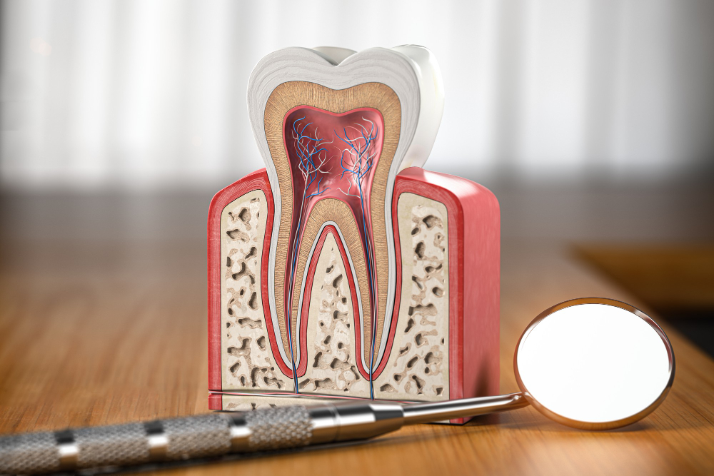 Root Canals in Indialantic