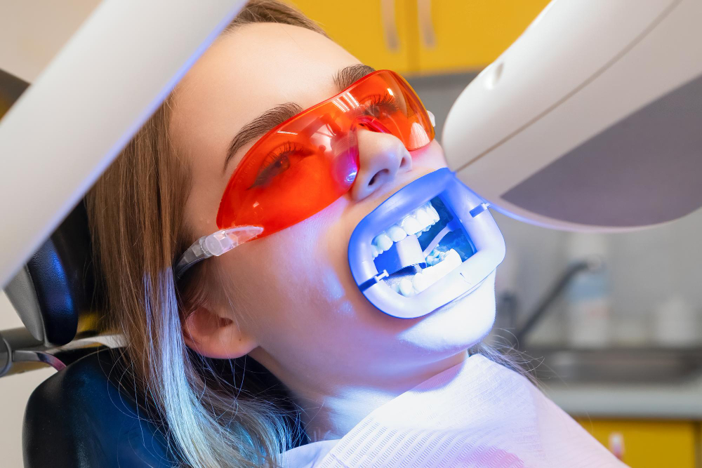 Teeth Whitening in Indialantic